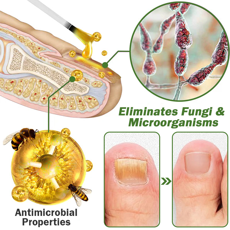 Furzero™ Nail Defense Bee Venom Treatment Serum (For All Kinds Of Nail Diseases-For Healthier Nail Growth)