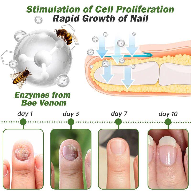 Furzero™ Nail Defense Bee Venom Treatment Serum (For All Kinds Of Nail Diseases-For Healthier Nail Growth)