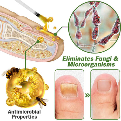 Furzero™ Nail Defense Bee Venom Treatment Serum (For All Kinds Of Nail Diseases-For Healthier Nail Growth)