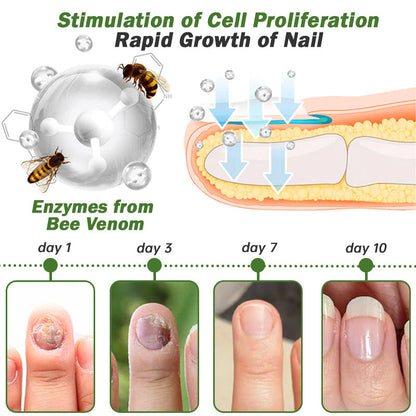 Furzero™ Nail Defense Bee Venom Treatment Serum (For All Kinds Of Nail Diseases-For Healthier Nail Growth)
